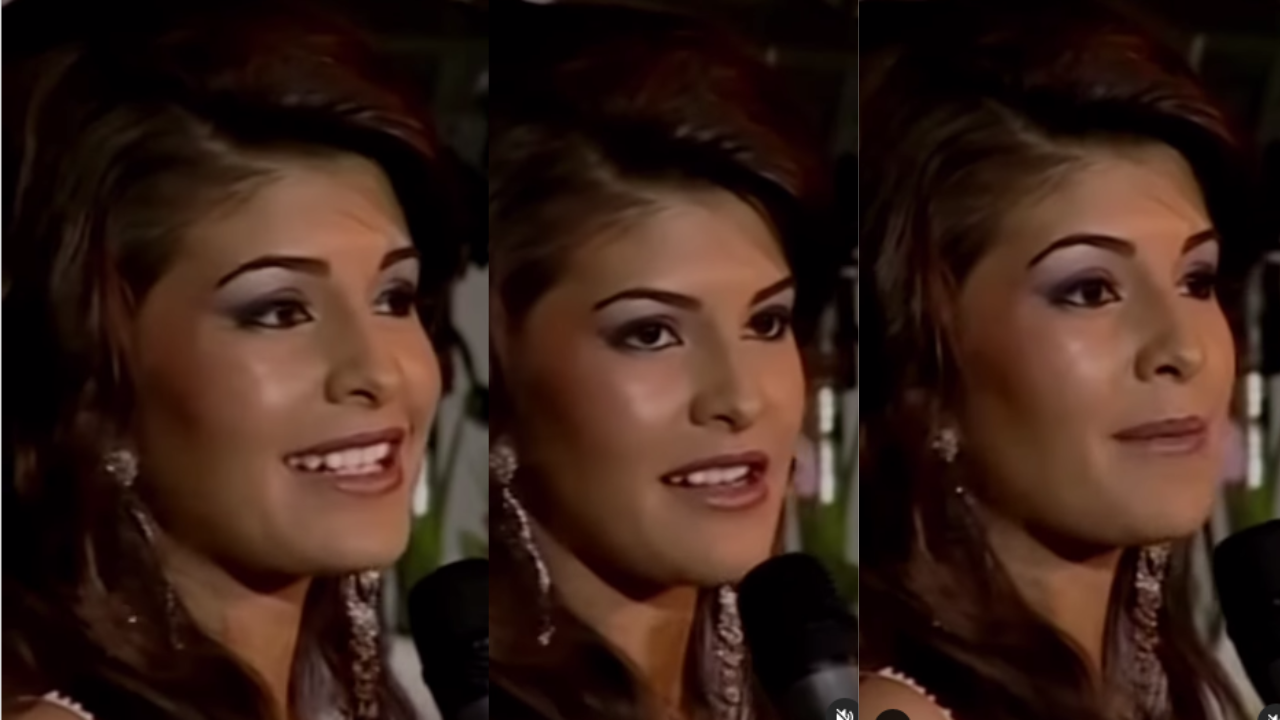 Jacqueline Fernandez Surgery: Jacqueline Fernandez ने सर्जरी पर तोड़ी चुप्पी, यूजर्स कर रहे ट्रोल Jacqueline Fernandez Surgery: Jacqueline Fernandez ने सर्जरी पर तोड़ी चुप्पी, यूजर्स कर रहे ट्रोल